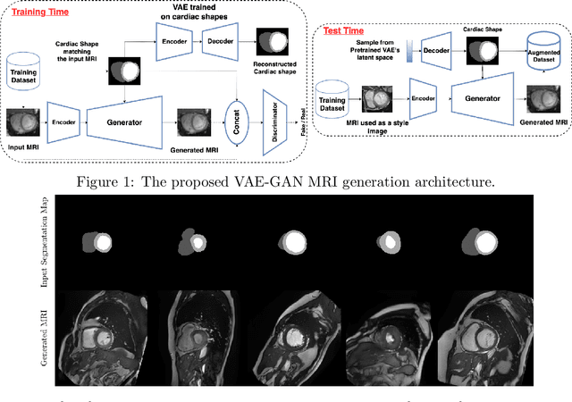 Figure 1 for On the effectiveness of GAN generated cardiac MRIs for segmentation