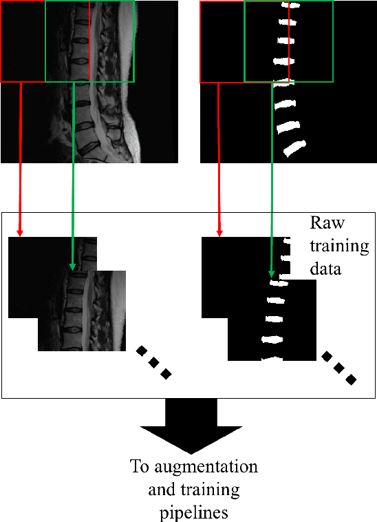 Figure 1 for Extreme Augmentation : Can deep learning based medical image segmentation be trained using a single manually delineated scan?