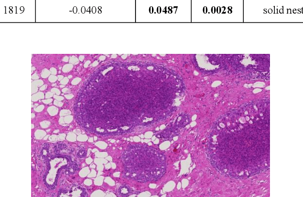 Figure 3 for A Computer-Aided Diagnosis System for Breast Pathology: A Deep Learning Approach with Model Interpretability from Pathological Perspective