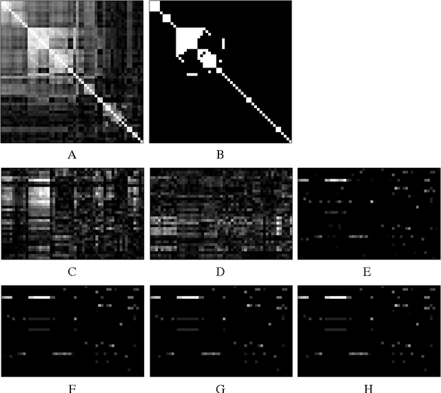 Figure 1 for A Multivariate Regression Approach to Association Analysis of Quantitative Trait Network