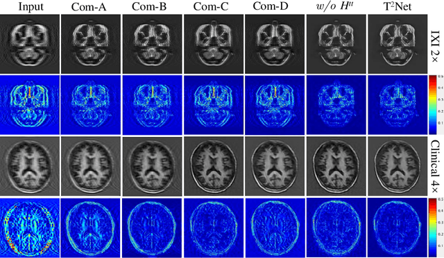 Figure 4 for Task Transformer Network for Joint MRI Reconstruction and Super-Resolution