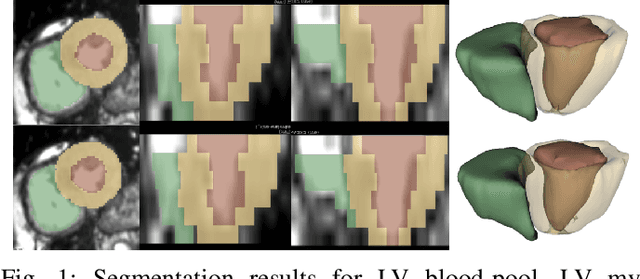 Figure 1 for A Distance Map Regularized CNN for Cardiac Cine MR Image Segmentation