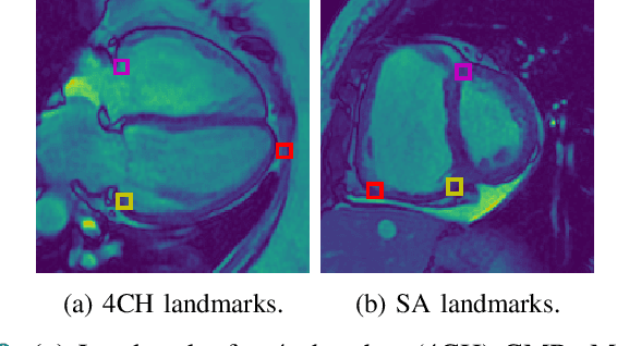 Figure 2 for Uncertainty Estimation for Heatmap-based Landmark Localization