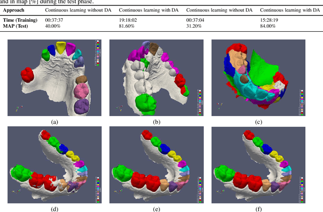 Figure 4 for Segmentation of 3D Dental Images Using Deep Learning