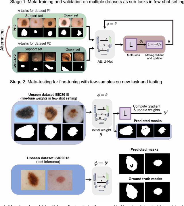 Figure 1 for Few-shot segmentation of medical images based on meta-learning with implicit gradients