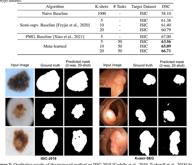 Figure 3 for Few-shot segmentation of medical images based on meta-learning with implicit gradients