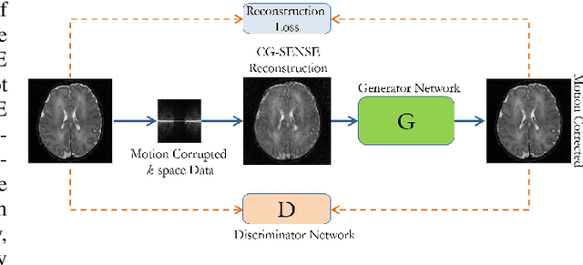 Figure 1 for Motion Corrected Multishot MRI Reconstruction Using Generative Networks with Sensitivity Encoding
