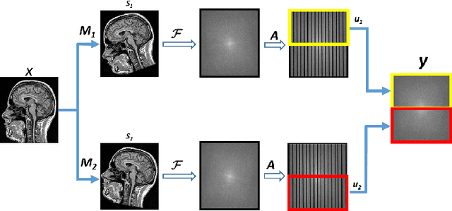Figure 2 for Motion Corrected Multishot MRI Reconstruction Using Generative Networks with Sensitivity Encoding