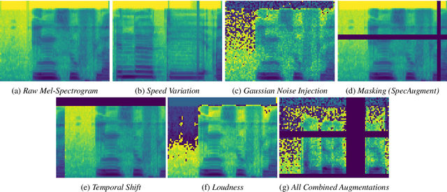 Figure 1 for Surgical Mask Detection with Convolutional Neural Networks and Data Augmentations on Spectrograms
