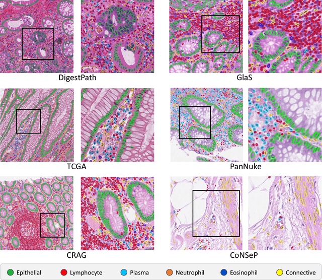 Figure 3 for Lizard: A Large-Scale Dataset for Colonic Nuclear Instance Segmentation and Classification