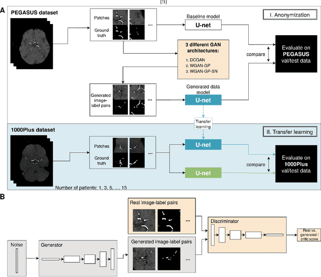 Figure 1 for Anonymization of labeled TOF-MRA images for brain vessel segmentation using generative adversarial networks