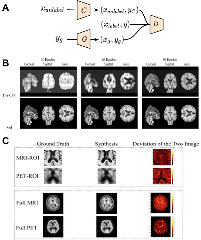 Figure 3 for Applications of Generative Adversarial Networks in Neuroimaging and Clinical Neuroscience