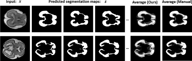 Figure 3 for Variational Inference for Quantifying Inter-observer Variability in Segmentation of Anatomical Structures