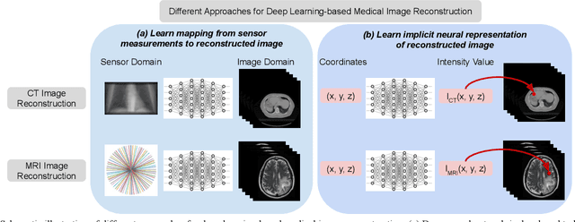 Figure 1 for NeRP: Implicit Neural Representation Learning with Prior Embedding for Sparsely Sampled Image Reconstruction