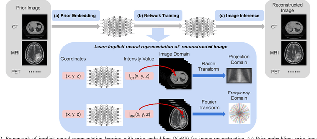 Figure 2 for NeRP: Implicit Neural Representation Learning with Prior Embedding for Sparsely Sampled Image Reconstruction