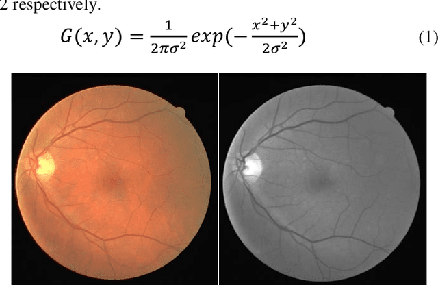 Figure 1 for Supervised Segmentation of Retinal Vessel Structures Using ANN