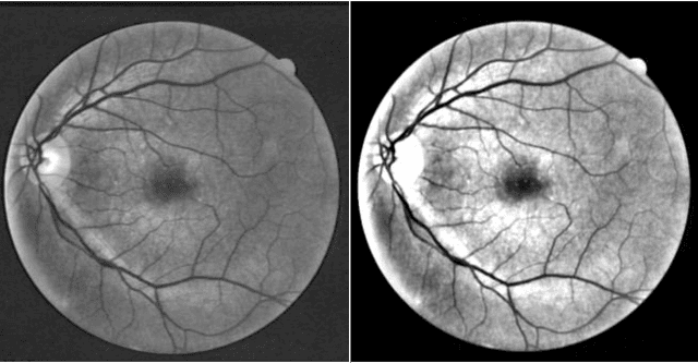 Figure 3 for Supervised Segmentation of Retinal Vessel Structures Using ANN