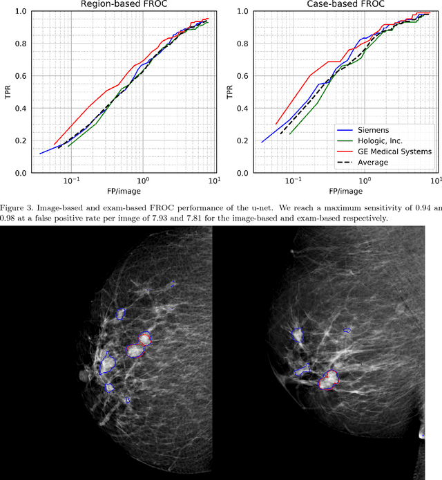 Figure 4 for Automated soft tissue lesion detection and segmentation in digital mammography using a u-net deep learning network