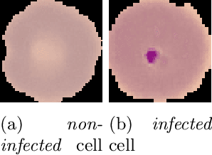 Figure 2 for Effect of Superpixel Aggregation on Explanations in LIME -- A Case Study with Biological Data