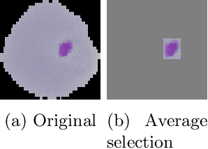 Figure 4 for Effect of Superpixel Aggregation on Explanations in LIME -- A Case Study with Biological Data