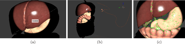 Figure 3 for Augmented Reality for Depth Cues in Monocular Minimally Invasive Surgery