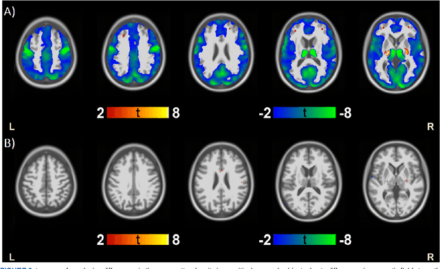 Figure 4 for Comparison of single and multitask learning for predicting cognitive decline based on MRI data