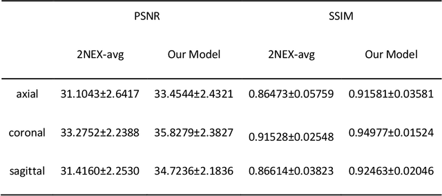Figure 3 for Denoising of Three-Dimensional Fast Spin Echo Magnetic Resonance Images of Knee Joints using Spatial-Variant Noise-Relevant Residual Learning of Convolution Neural Network