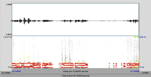 Figure 3 for Automatic analysis of Categorical Verbal Fluency for Mild Cognitive Impartment detection: a non-linear language independent approach