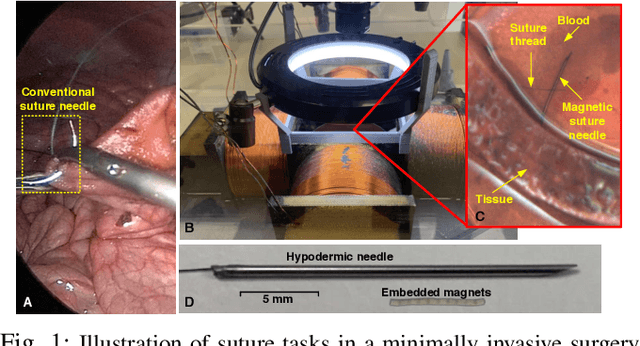 Figure 1 for Localization and Control of Magnetic Suture Needles in Cluttered Surgical Site with Blood and Tissue