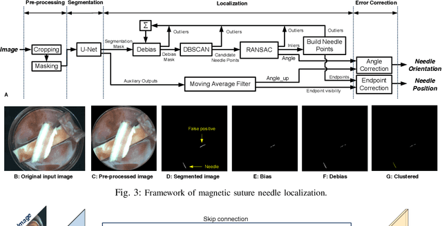 Figure 3 for Localization and Control of Magnetic Suture Needles in Cluttered Surgical Site with Blood and Tissue