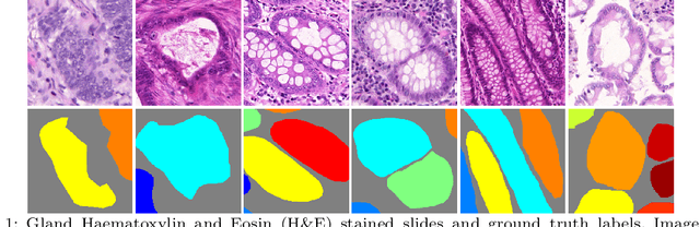 Figure 1 for Gland Instance Segmentation by Deep Multichannel Side Supervision