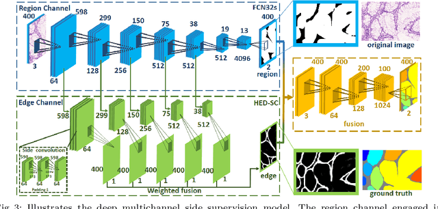 Figure 4 for Gland Instance Segmentation by Deep Multichannel Side Supervision