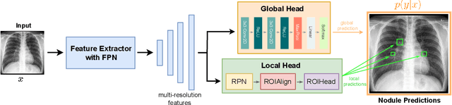 Figure 1 for Multi-Task Lung Nodule Detection in Chest Radiographs with a Dual Head Network