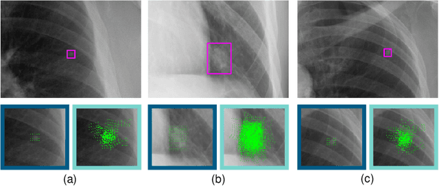 Figure 3 for Multi-Task Lung Nodule Detection in Chest Radiographs with a Dual Head Network