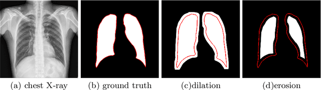 Figure 3 for Cascaded Robust Learning at Imperfect Labels for Chest X-ray Segmentation