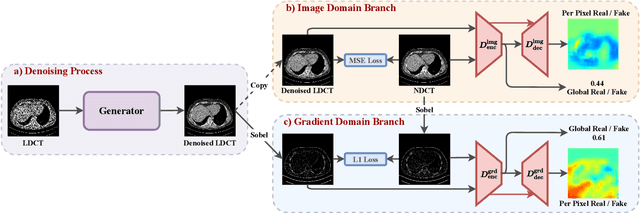 Figure 1 for DU-GAN: Generative Adversarial Networks with Dual-Domain U-Net Based Discriminators for Low-Dose CT Denoising