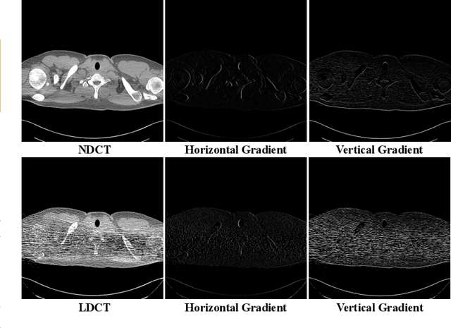 Figure 3 for DU-GAN: Generative Adversarial Networks with Dual-Domain U-Net Based Discriminators for Low-Dose CT Denoising