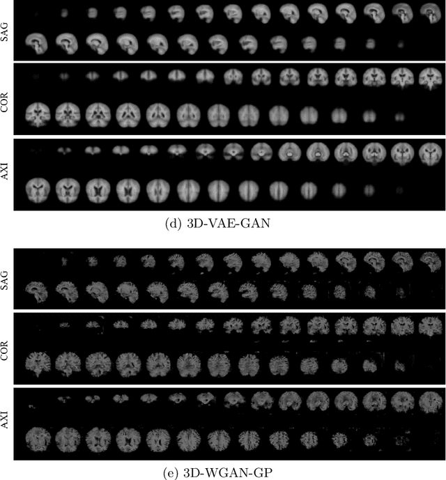 Figure 3 for Generation of 3D Brain MRI Using Auto-Encoding Generative Adversarial Networks