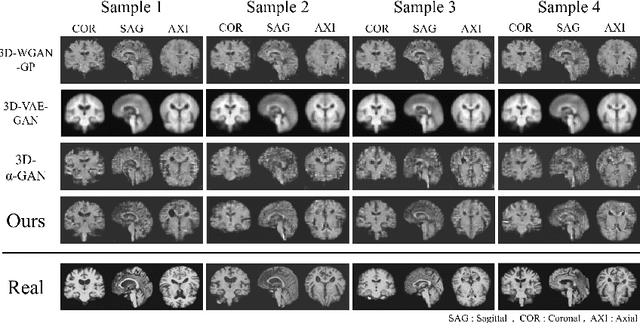 Figure 4 for Generation of 3D Brain MRI Using Auto-Encoding Generative Adversarial Networks