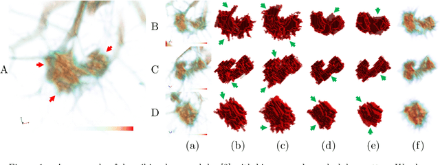 Figure 1 for 3D Matting: A Soft Segmentation Method Applied in Computed Tomography