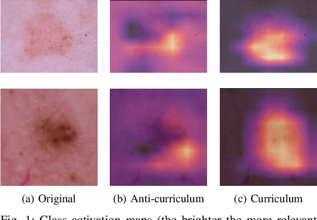 Figure 1 for Improved skin lesion recognition by a Self-Supervised Curricular Deep Learning approach