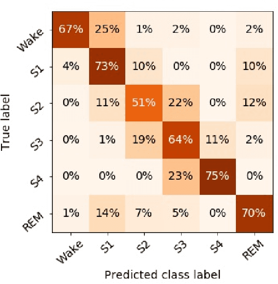 Figure 3 for Addressing Class Imbalance in Classification Problems of Noisy Signals by using Fourier Transform Surrogates