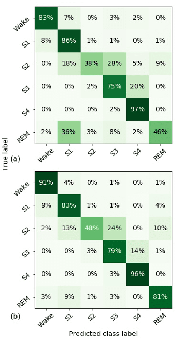 Figure 4 for Addressing Class Imbalance in Classification Problems of Noisy Signals by using Fourier Transform Surrogates