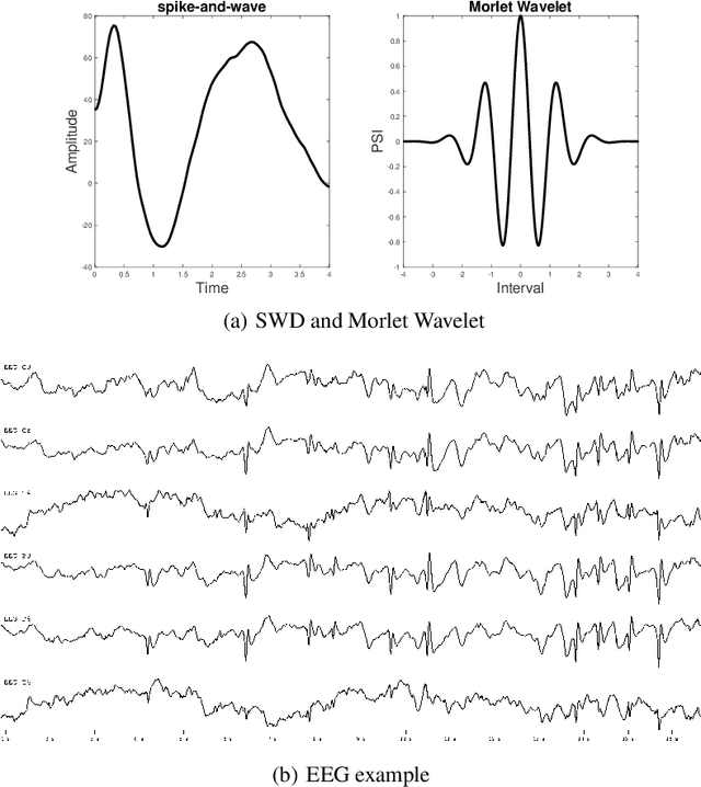 Figure 1 for A novel spike-and-wave automatic detection in EEG signals