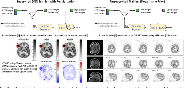 Figure 2 for Physics-driven Deep Learning for PET/MRI
