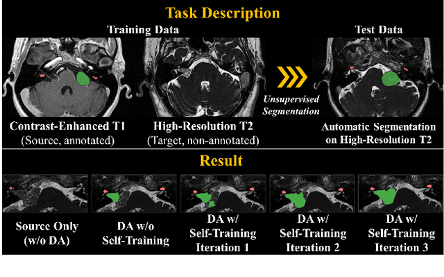 Figure 1 for COSMOS: Cross-Modality Unsupervised Domain Adaptation for 3D Medical Image Segmentation based on Target-aware Domain Translation and Iterative Self-Training