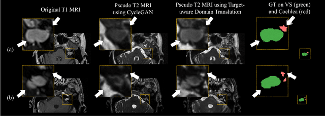 Figure 4 for COSMOS: Cross-Modality Unsupervised Domain Adaptation for 3D Medical Image Segmentation based on Target-aware Domain Translation and Iterative Self-Training