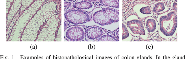 Figure 1 for AttentionBoost: Learning What to Attend by Boosting Fully Convolutional Networks