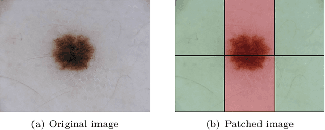 Figure 3 for Skin cancer detection based on deep learning and entropy to detect outlier samples