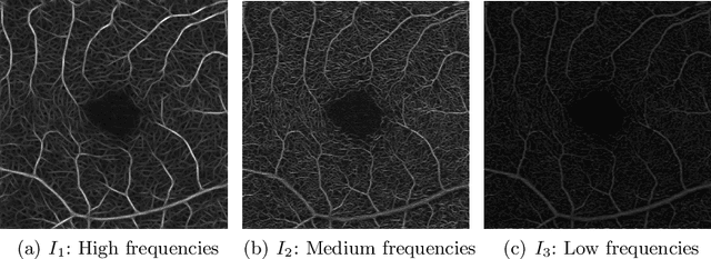 Figure 1 for Blood vessel segmentation in en-face OCTA images: a frequency based method